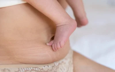 Fisioterapia post parto: recuperación segura tras el embarazo